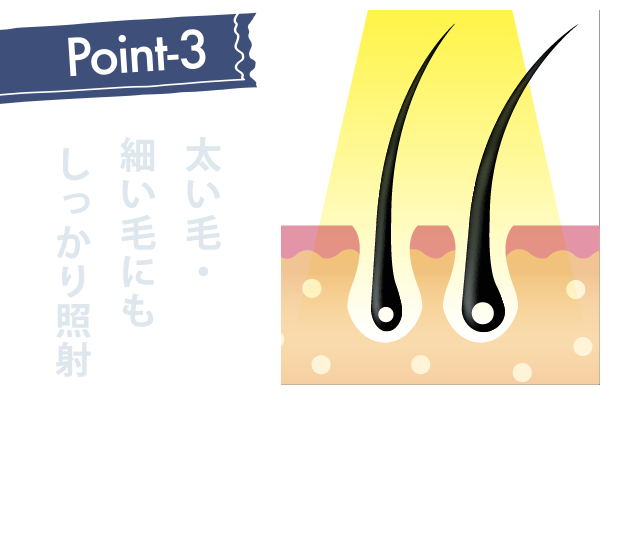 太い毛・細い毛にもしっかり照射