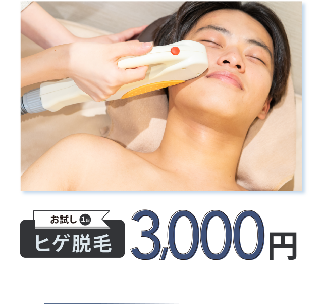 ヒゲ脱毛3000円