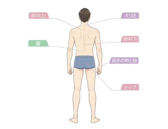 背面メンズ脱毛